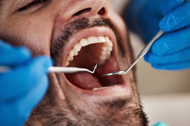Best Emergency Root Canal Treatment in Archdale, NC