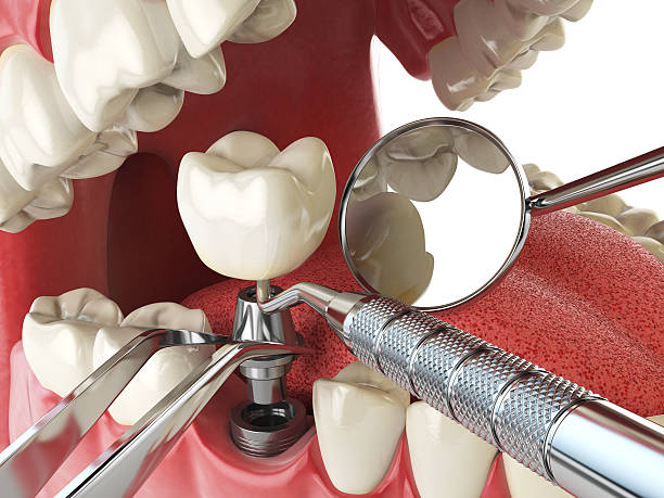 Best Emergency Dental Surgery in Archdale, NC